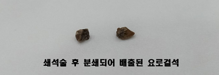 원인