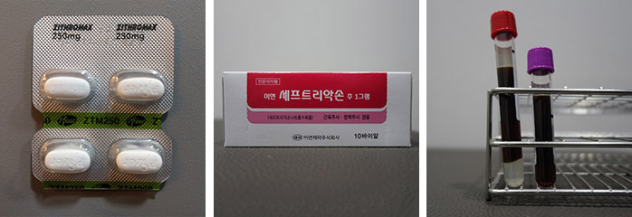 치료 방법 및 주의사항