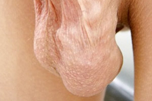 주로 호소하는 증상