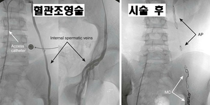 치료 방법 및 주의사항