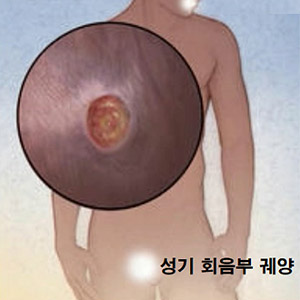 주로 호소하는 증상